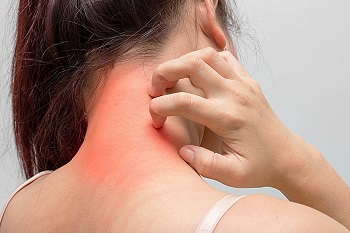 Dermatiti