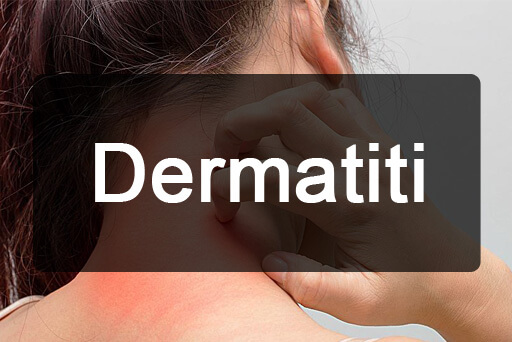 Dermatiti
